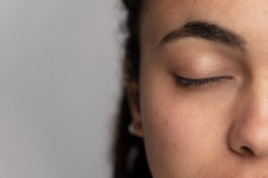 tratament pori dilatati